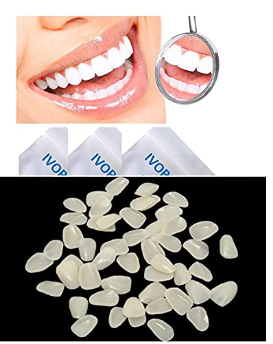 IVORIE® קוסמטי אולטרה -מלבנה דק פורניר שרף שיניים קדמיות עליונות 50 יחידות